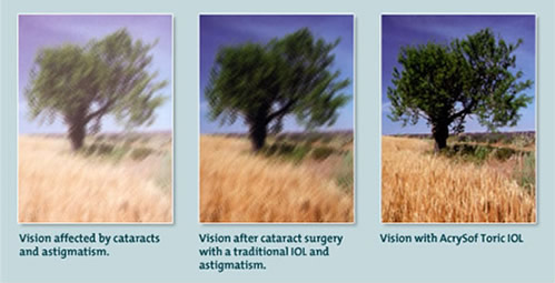 Image of a tree shown three times with blurriness levels to indicate how cataracts and astigmatism affect vision